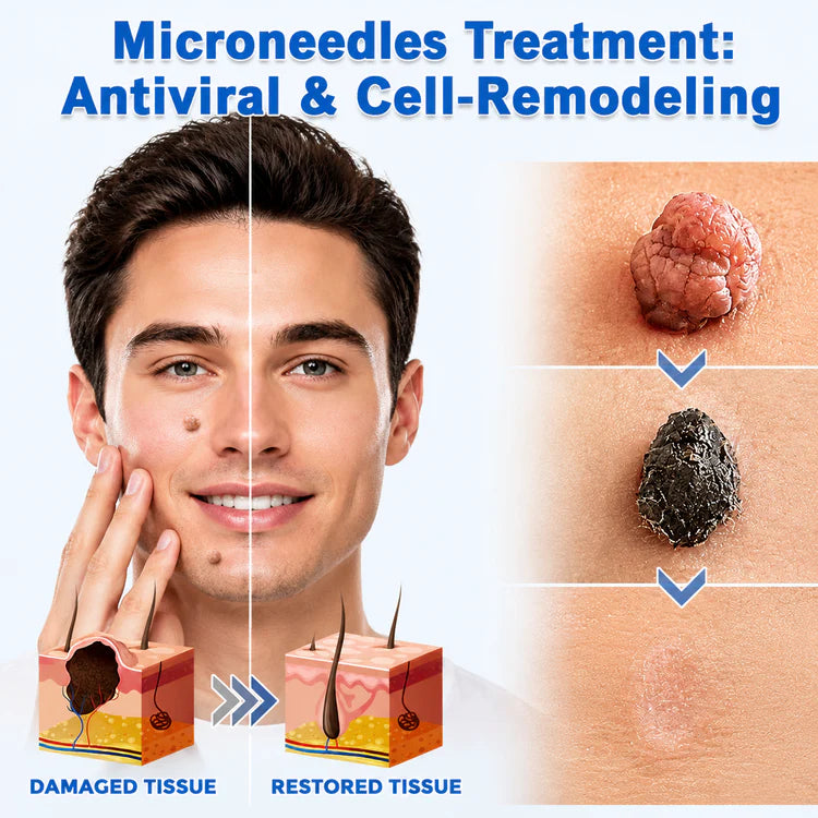 Curalona® 2-in-1 Microneedle & Hydrocolloid Patch 144 pack