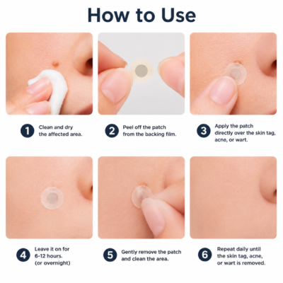 Curalona® star-shaped spot care patches