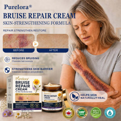 Purelora® arnica and vitamin K cream for legs
