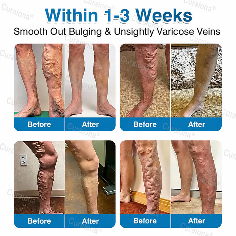 Curalona® patch roll with red vine leaf extract