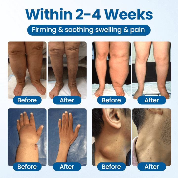Relieflogix™ cooling topical roll-on