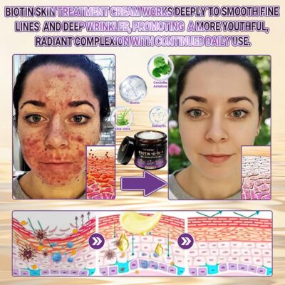 MoleScarCure Biotin 10-in-1 Skin Restoration Cream
