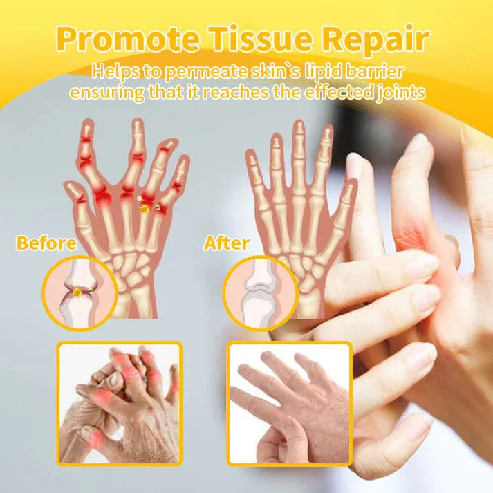 Relieflogix Bee Venom Bone Care Cream for back and shoulders