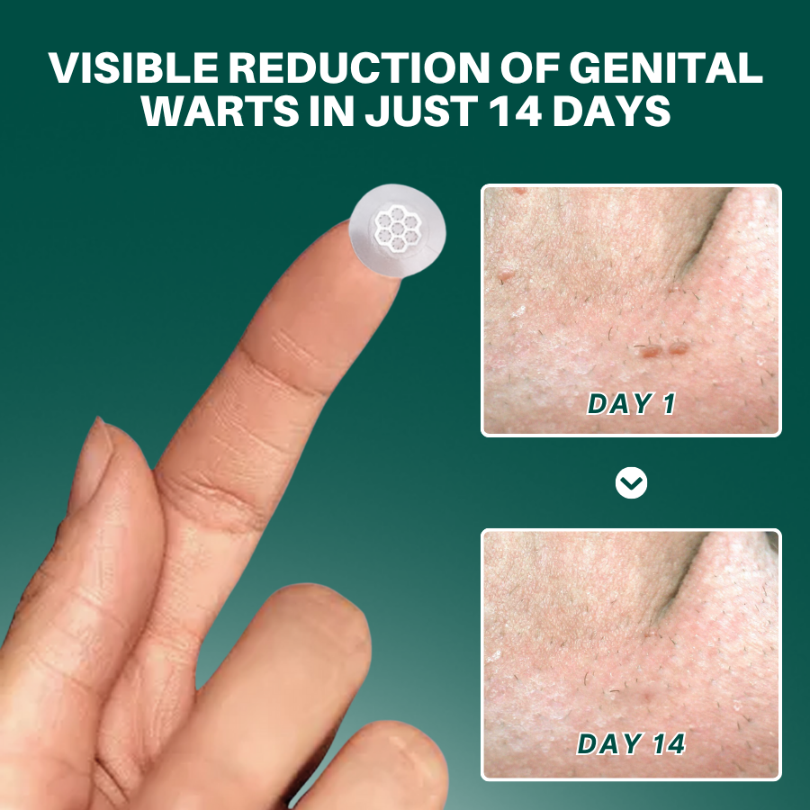 Fivfivgo MicroPin patch with magnesium and botanical actives