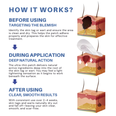Fivfivgo ultra-thin adhesive patch for skin tags and warts