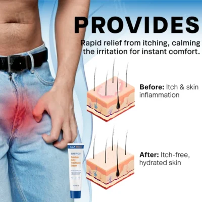 Fivfivgo steroid-free groin care cream with Calendula