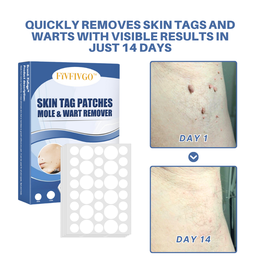 Fivfivgo botanical adhesive patch for targeted skin tag care