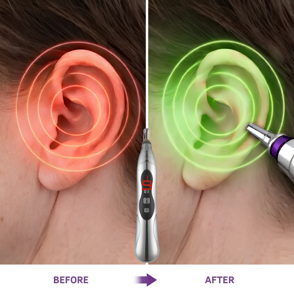 TinniEase device designed to help reduce tinnitus ringing